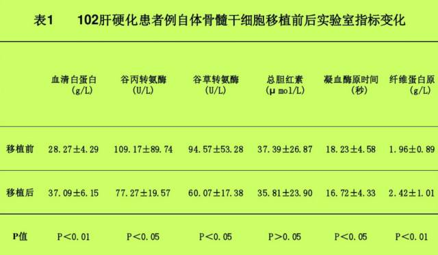 自体骨髓干细胞移植治疗肝硬化102例报告。