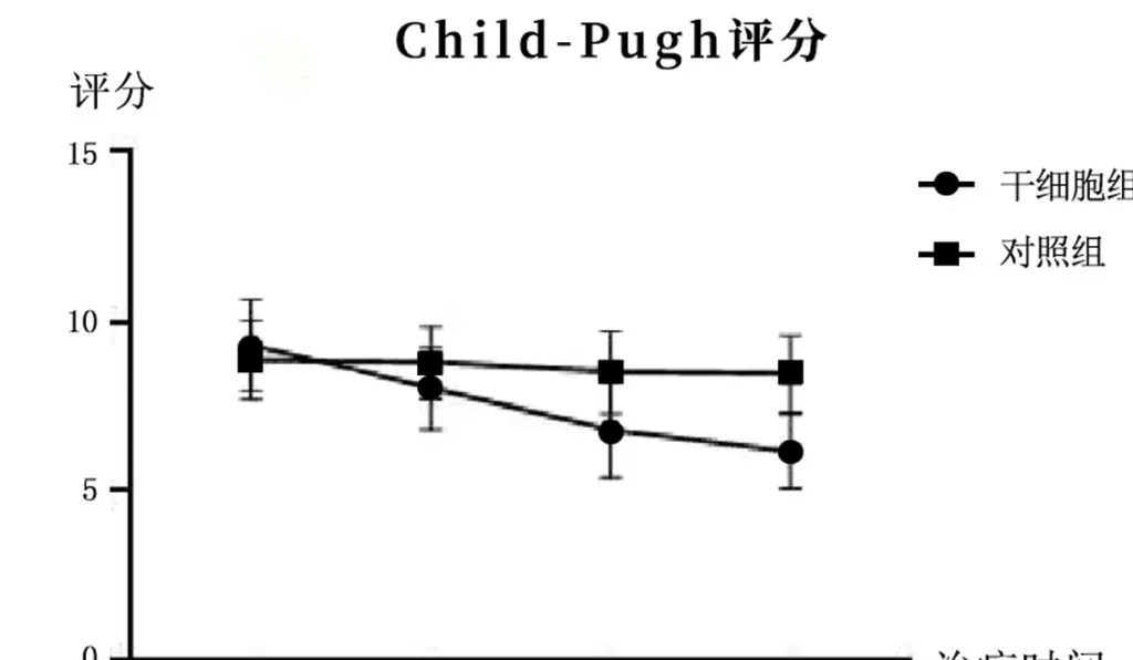 2005年干细胞治疗肝硬化临床案例