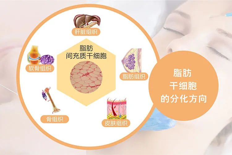 什么是脂肪干细胞：脂肪干细胞来源、临床应用