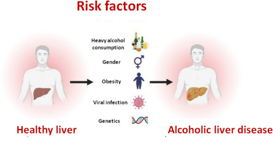 酒精性肝病风险因素