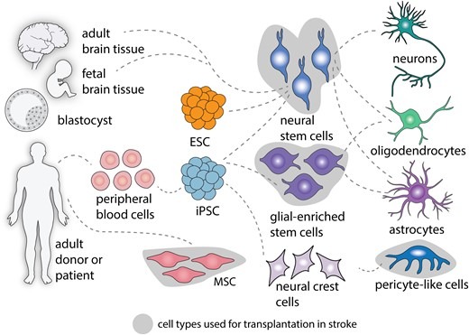 图2：中风后细胞治疗的细胞类型。