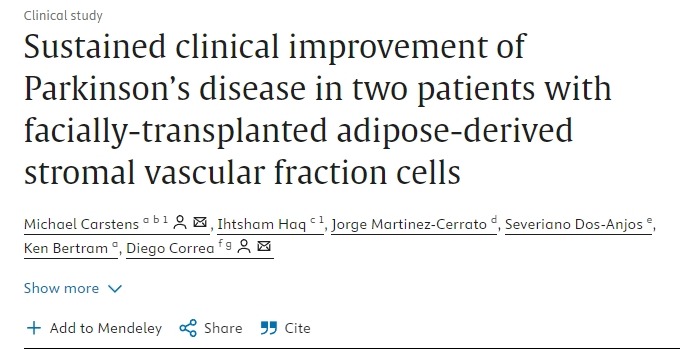 ‘两例接受面部移植脂肪来源干细胞治疗的帕金森病患者临床症状持续改善