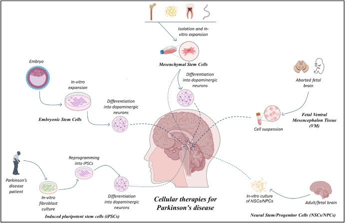 图1：帕金森病的细胞疗法：胚胎干细胞 (ESC)、诱导性多能干细胞 (iPSC)、间充质干细胞 (MSC)、神经干细胞/祖细胞 (NSC/NPS) 是帕金森病的新兴候选药物。