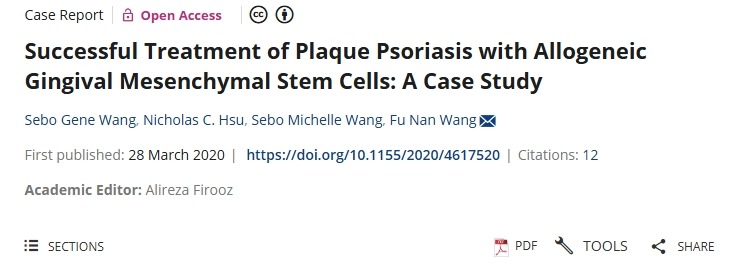 用同种异体牙龈间充质干细胞成功治疗斑块状银屑病：案例研究