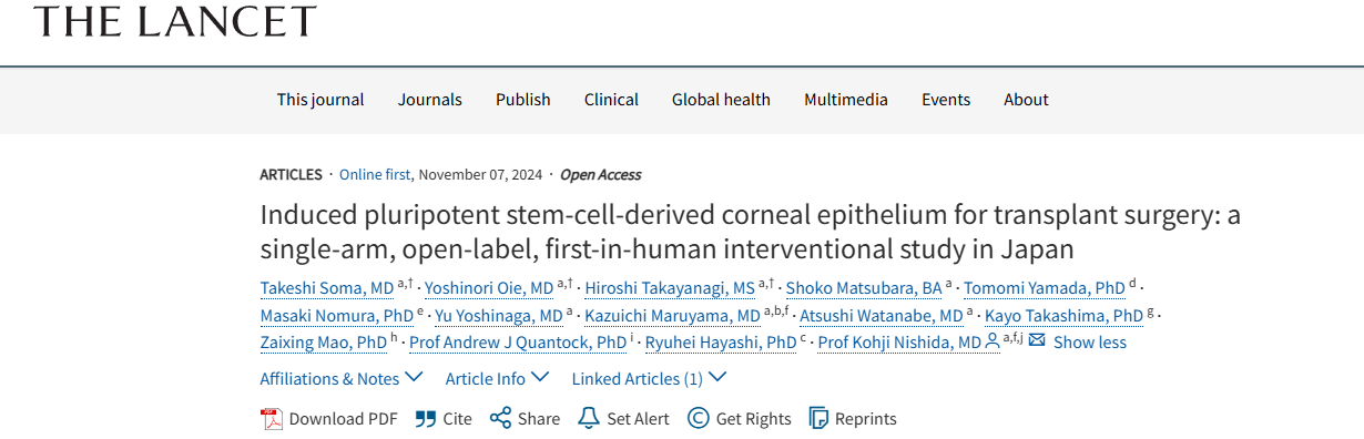 《诱导性多能干细胞来源的角膜上皮用于移植手术：日本的一项单臂、开放标签、首次人体介入研究》
