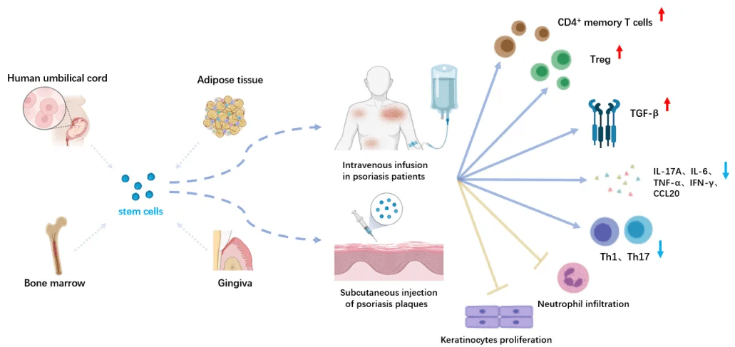 图3：干细胞在银屑病治疗中的应用